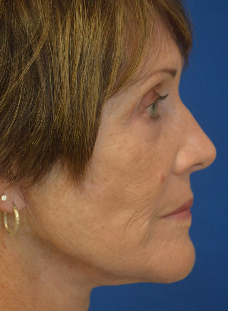 WI-06of06