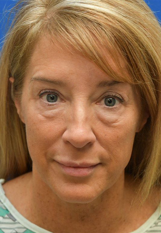 4739-p05-1