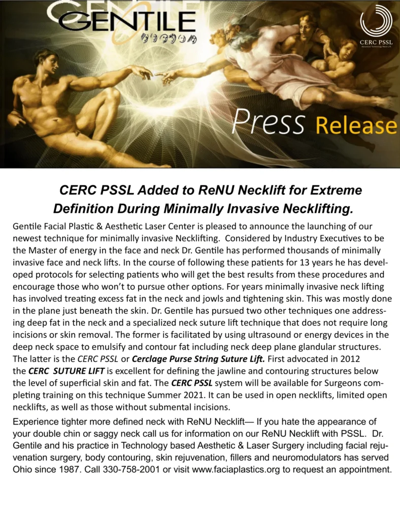 CERC PSSL added to ReNU Necklift for extreme definition press release