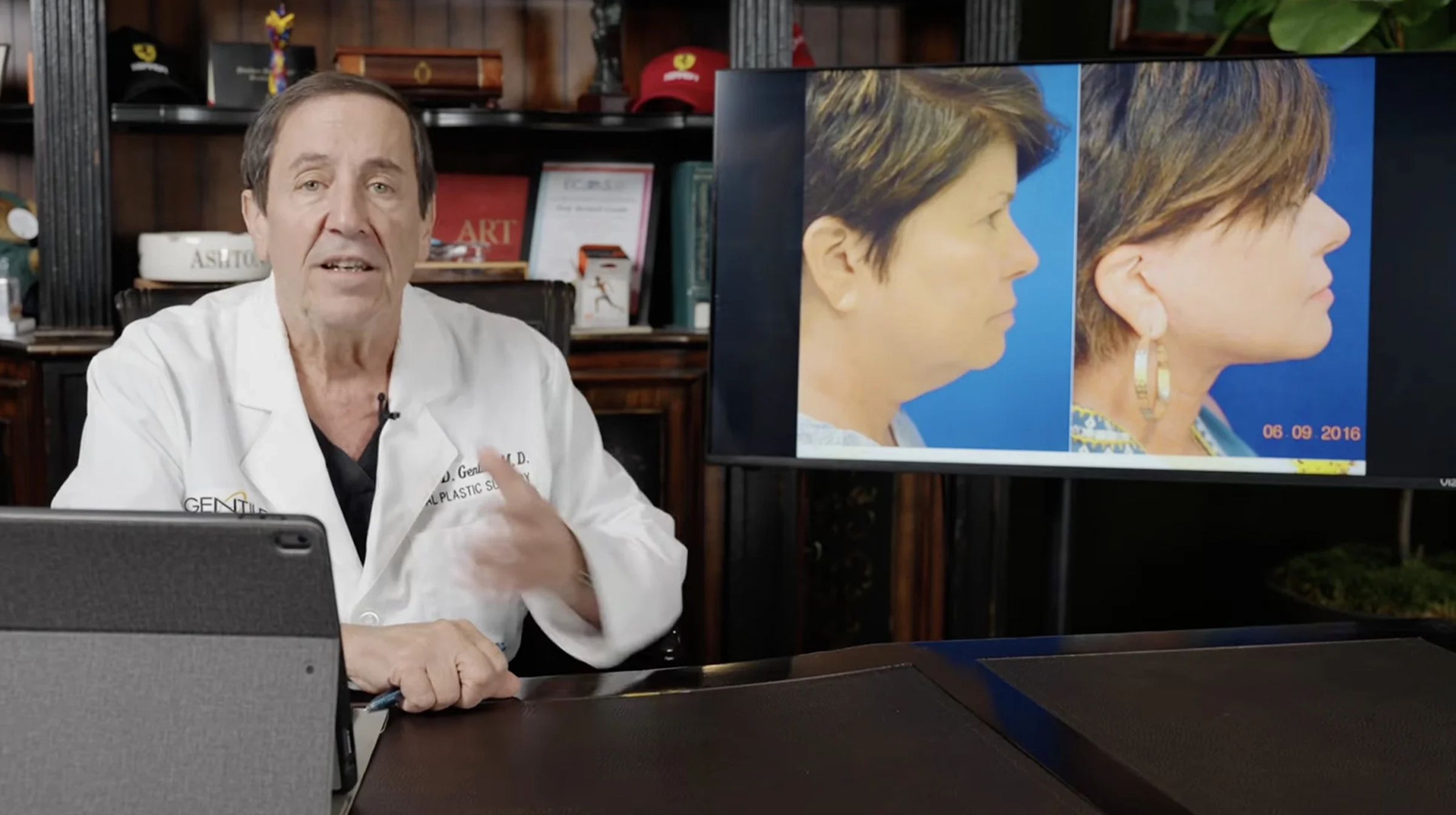 procedure-facelift-video (1)